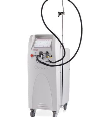 VBeam Perfecta for Vascular Lesions and Scar Treatment Austin TX