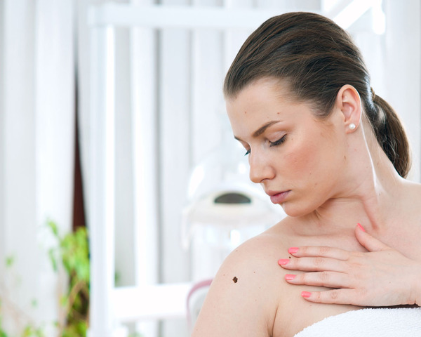 Common Areas for Melanoma: How To Check For Melanoma