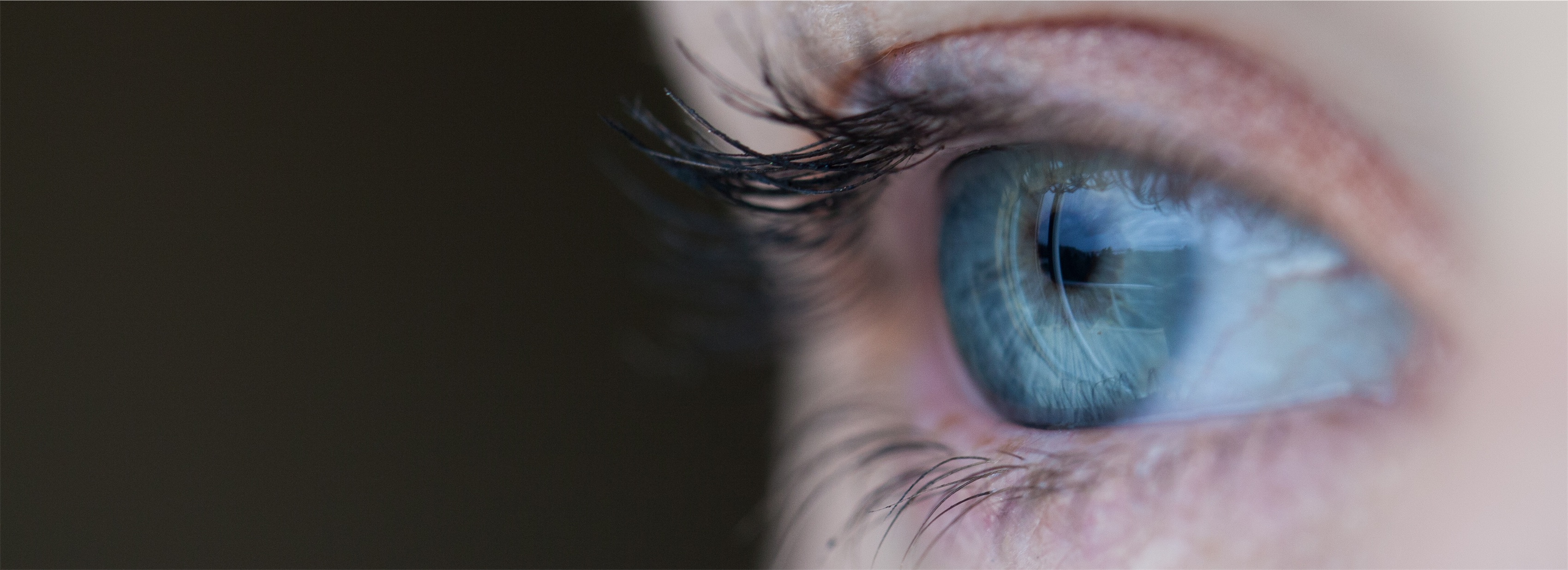 Syringoma