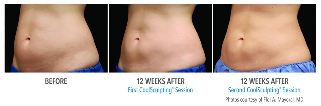 B&A-Mayoral-AB-3Set-24wk-3Q-HiRes