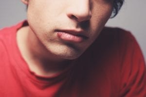 Herpes Simplex