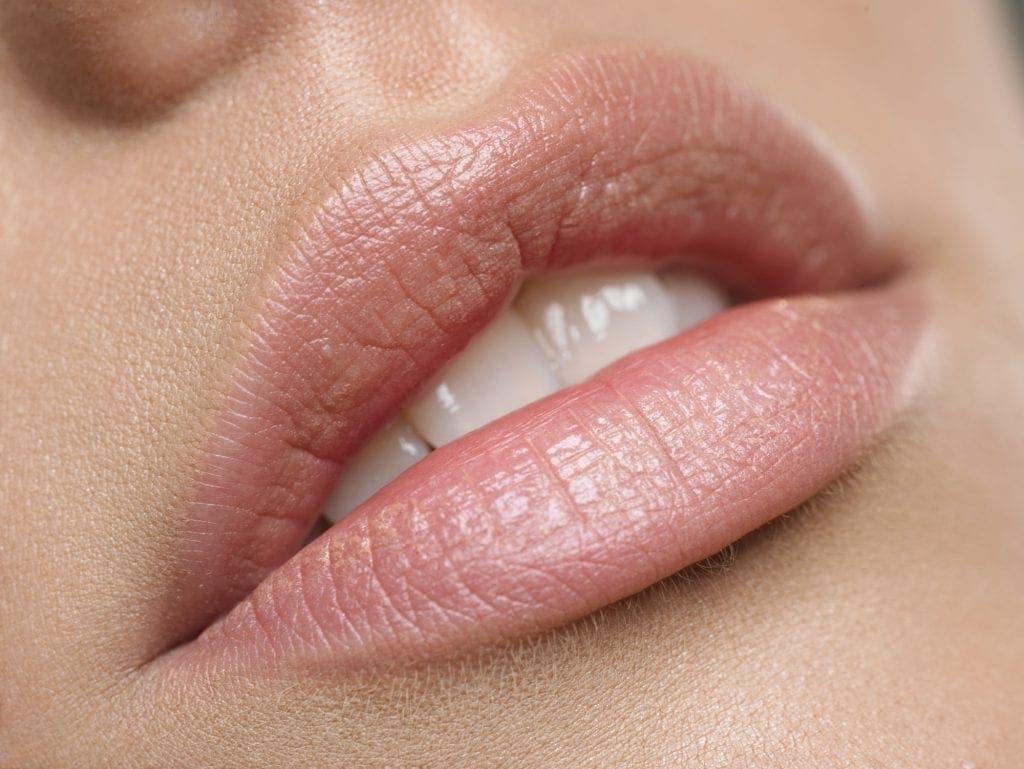 Juvederm Volbella vs. Restylane Silk for Lip Augmentation
