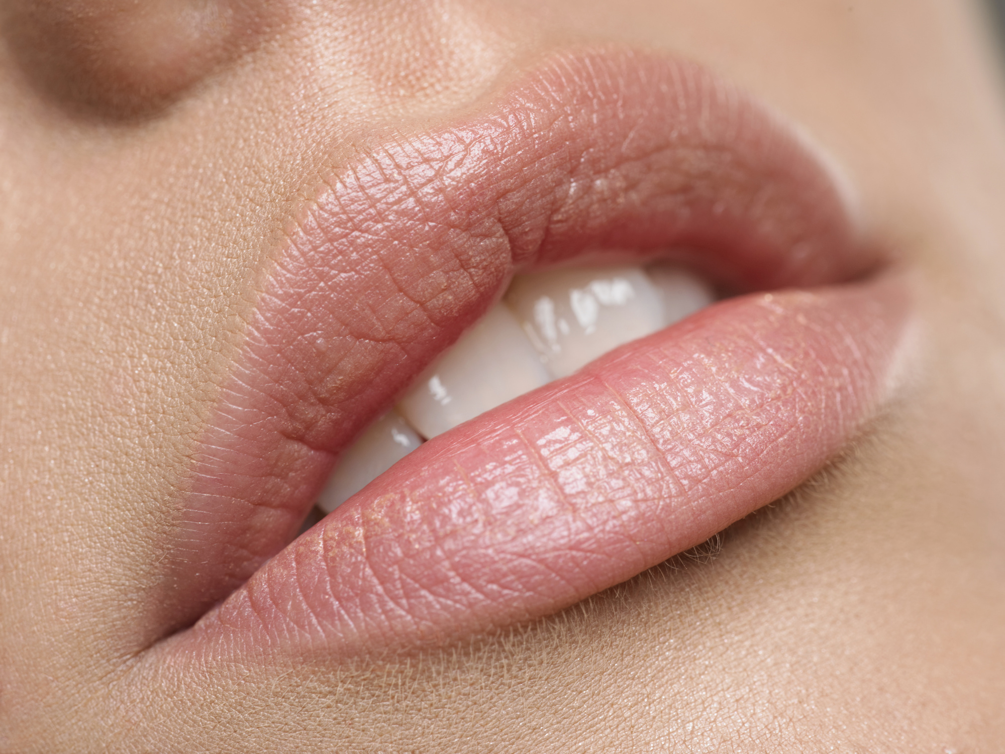 Dermal Filler in Austin, TX