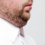 young man with a double chin - the result of poor lifestyle