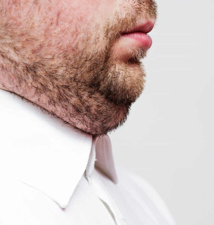 Non-invasive Cosmetic Treatment in Austin, TX