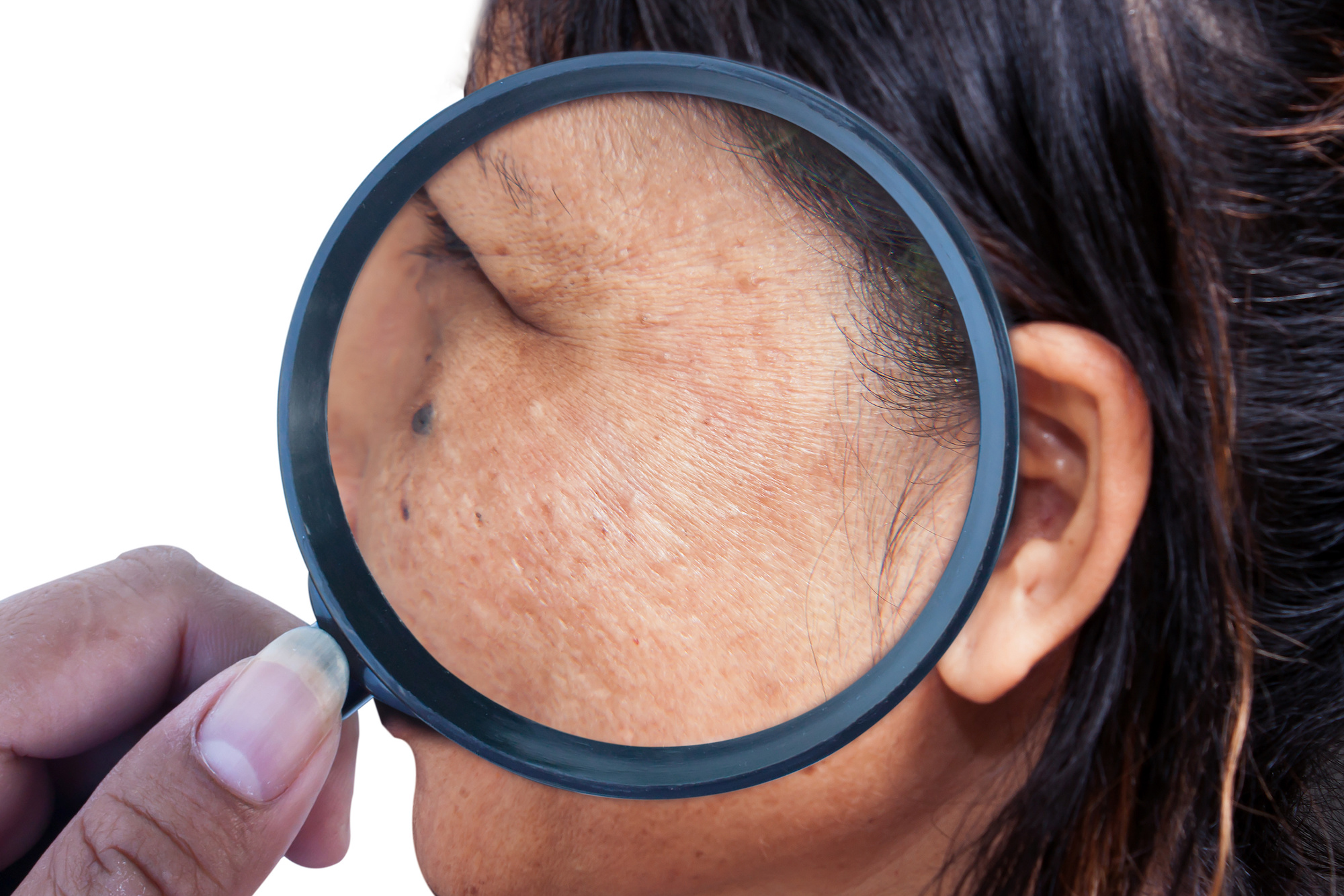 Skin Damaged Treatment in Austin, TX