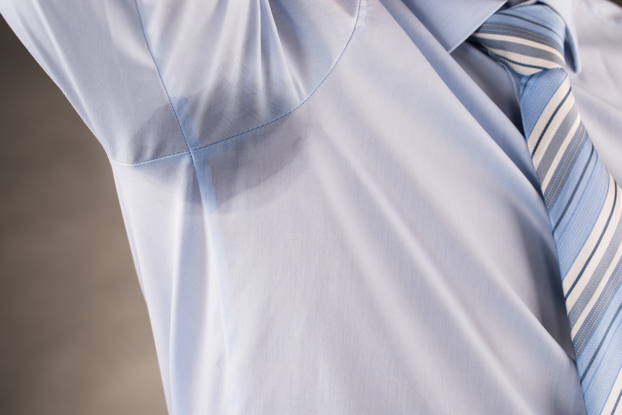 Hyperhidrosis Treatment in Austin, TX