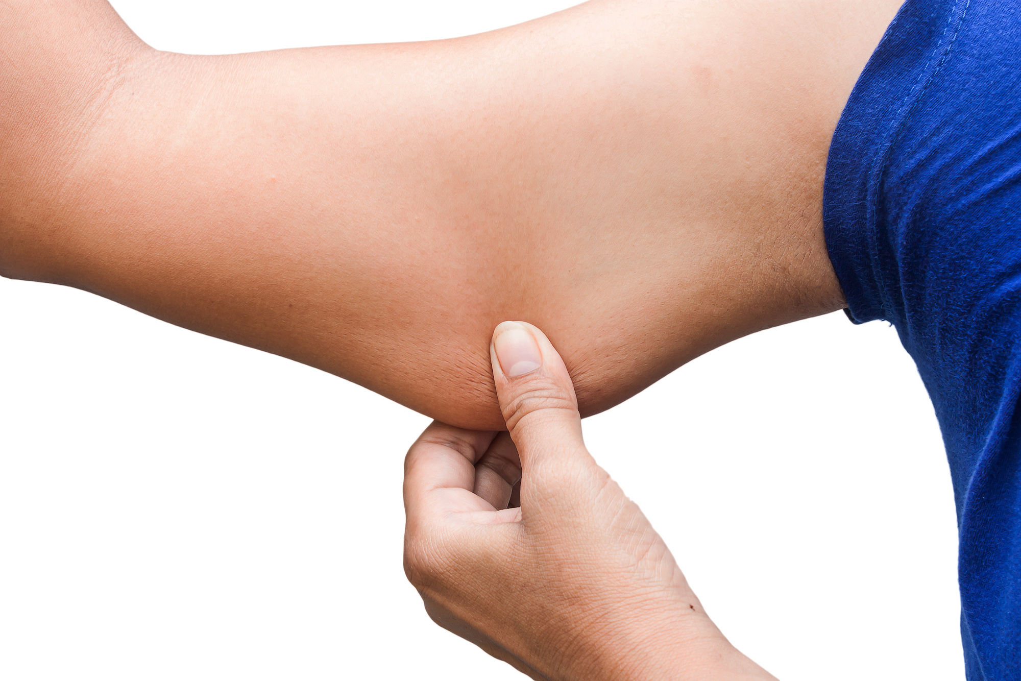CoolSculpting in Austin, TX