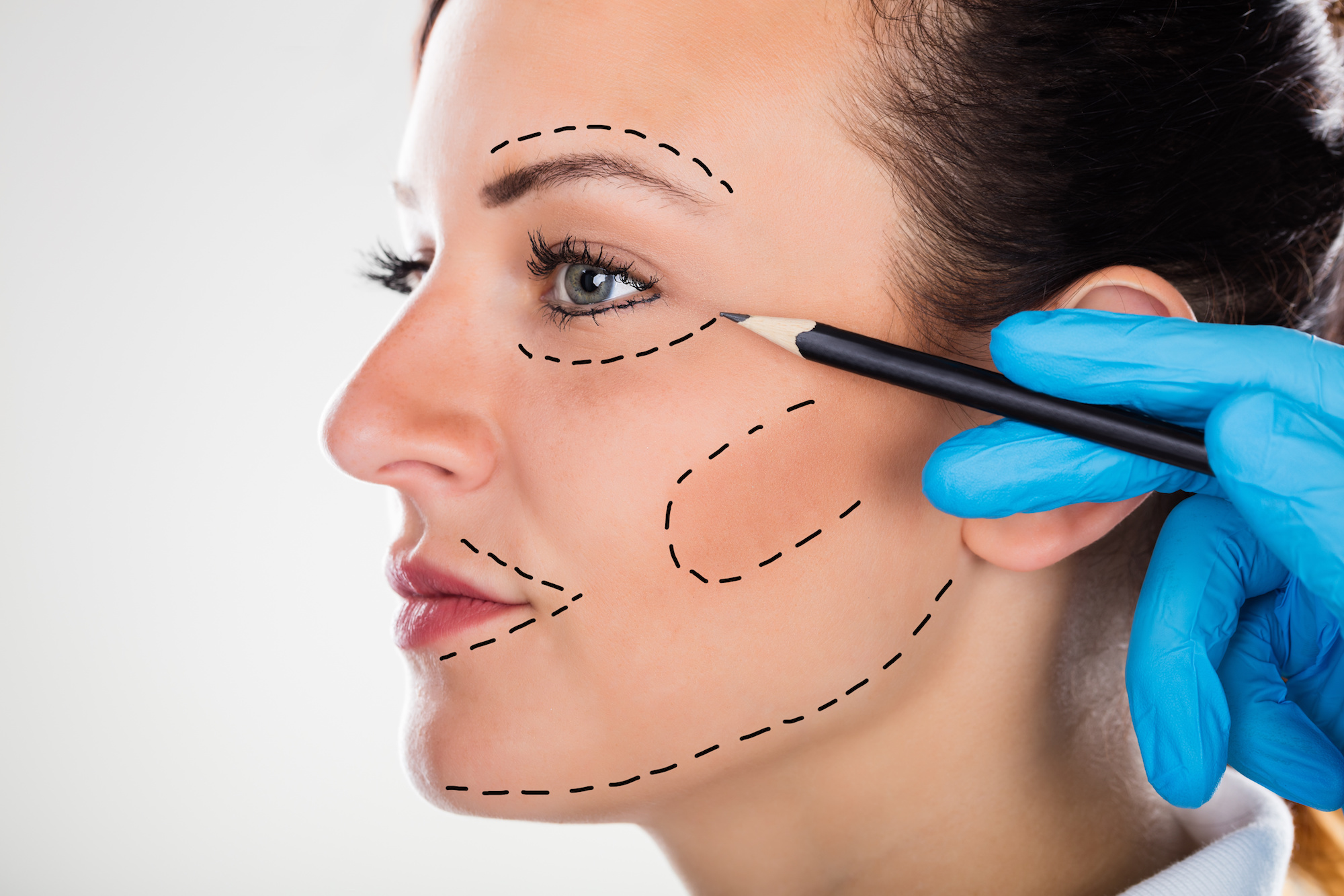 Getting Tighter Skin Without A Facelift: What Are Your Options?