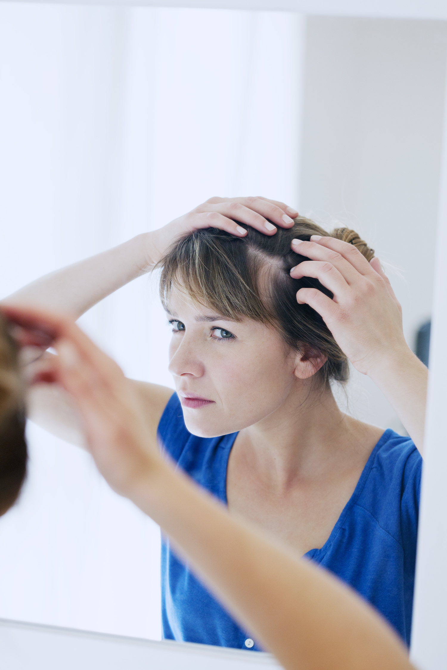 PRP for Female Pattern Hair Loss