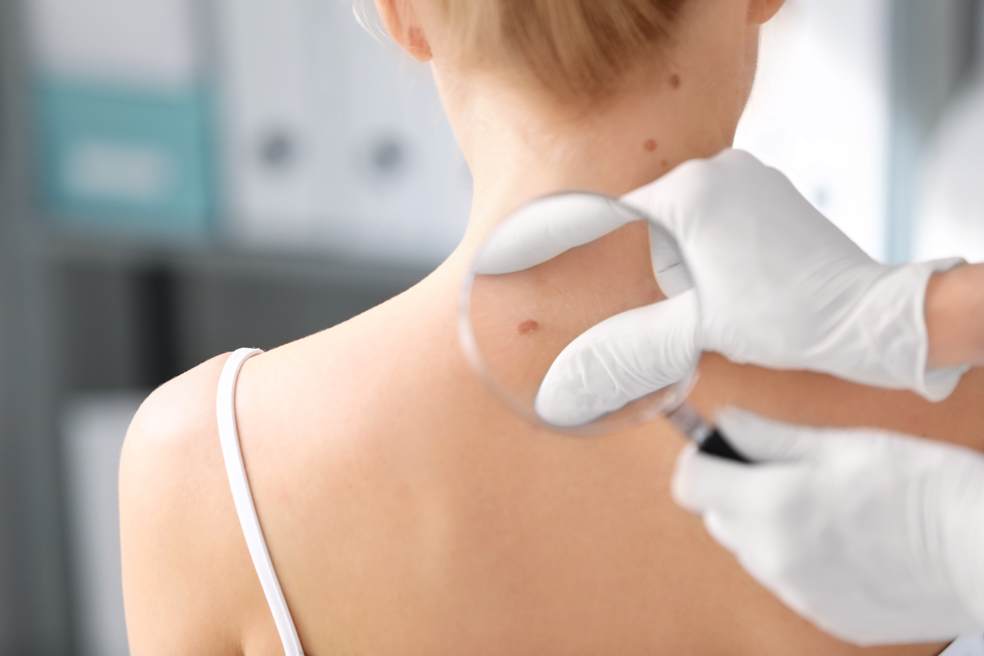 Skin Biopsy in Austin, TX