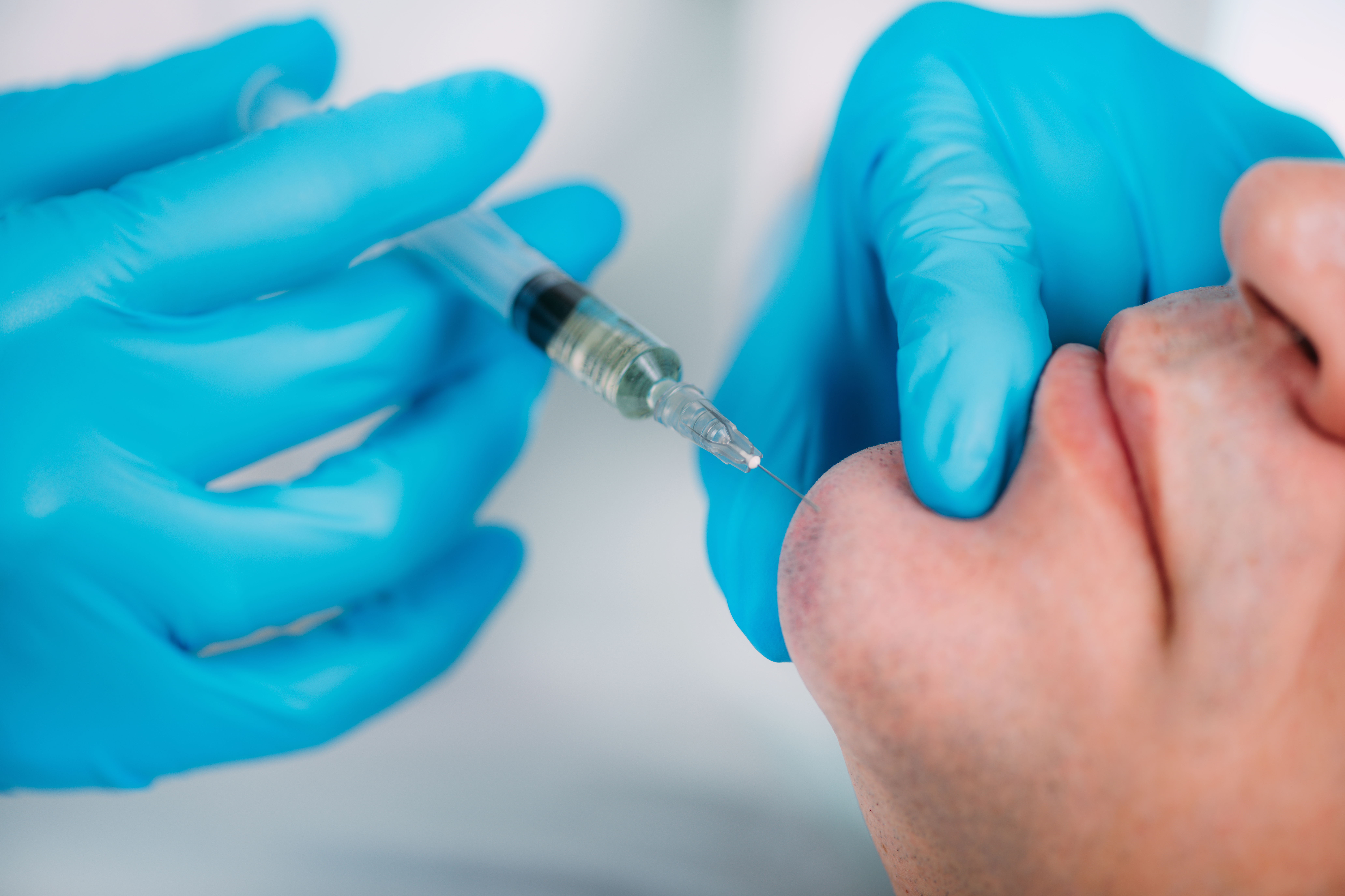 Juvéderm® Filler in Austin, TX