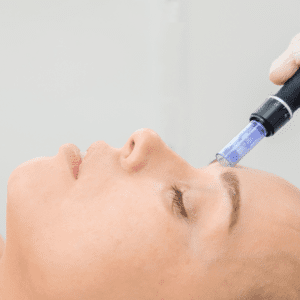 Microneedling + PRP in Pflugerville, TX