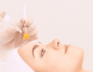 Woman laying down receiving chemical peel with brush