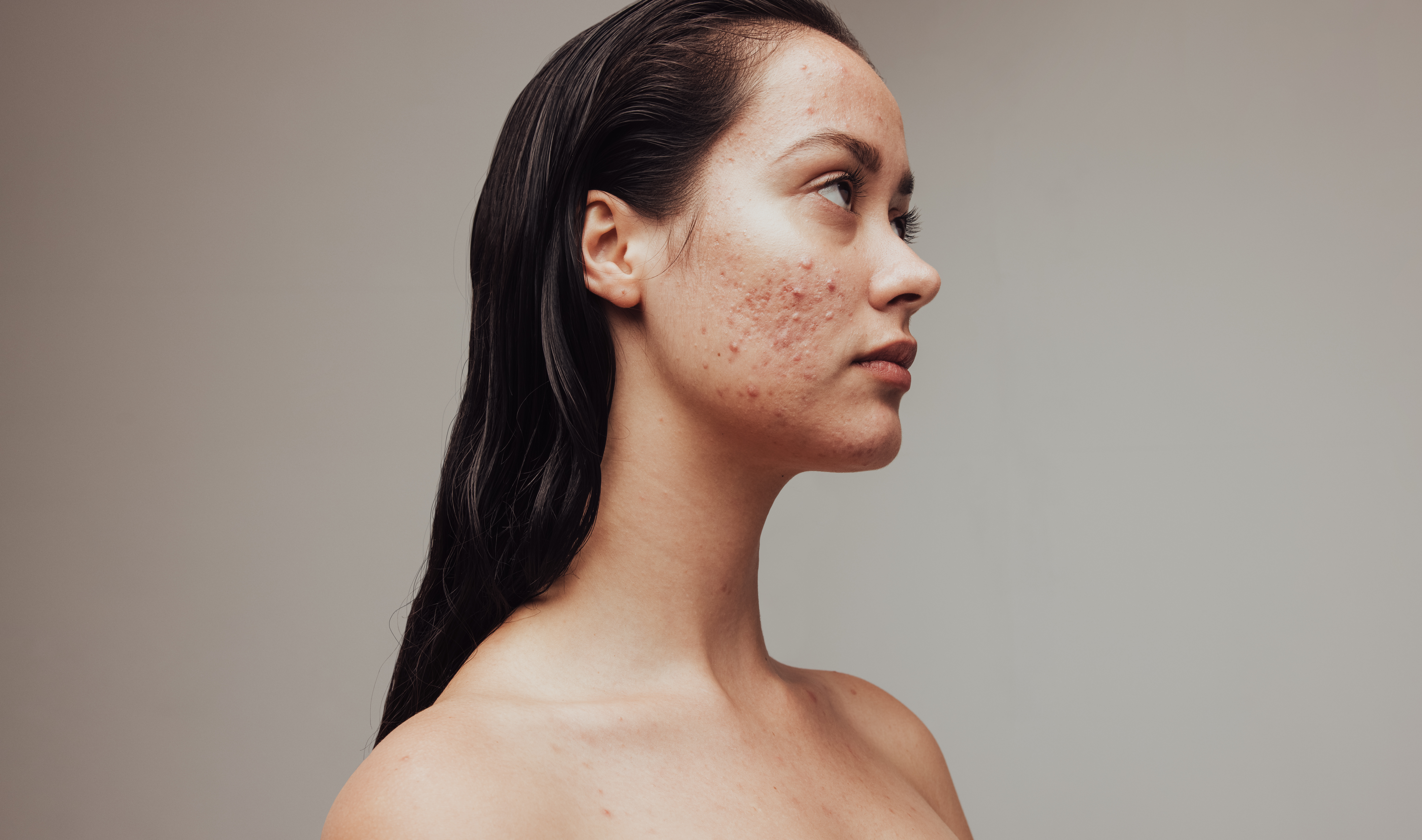 Dermatology Clinical Trial