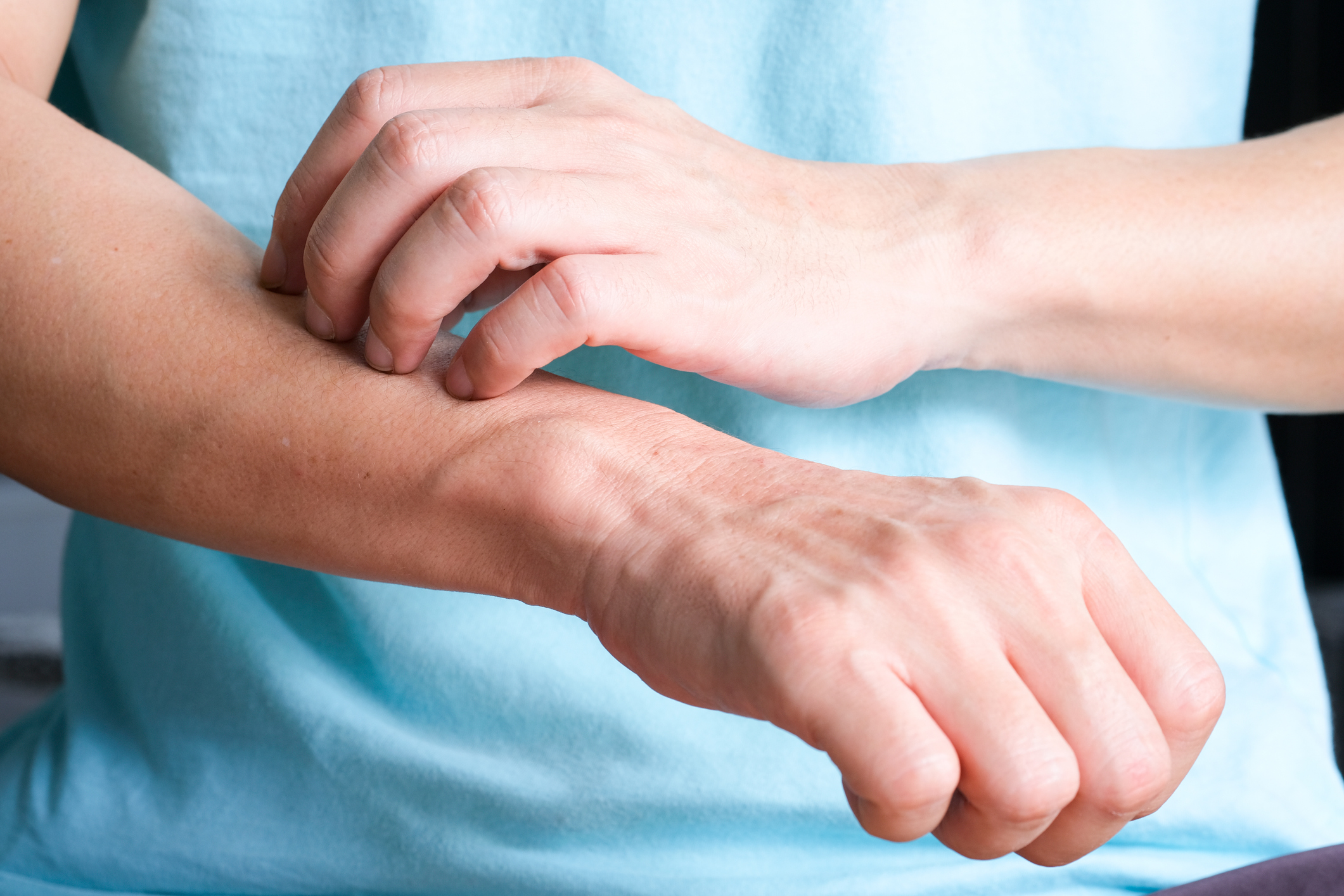 The man's hands he uses his hands to scratch his back because of dermatitis and itch sensation. Yearly Skin Check