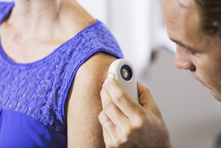 Dermatologist examining patient What Is An Epidermoid Cyst?