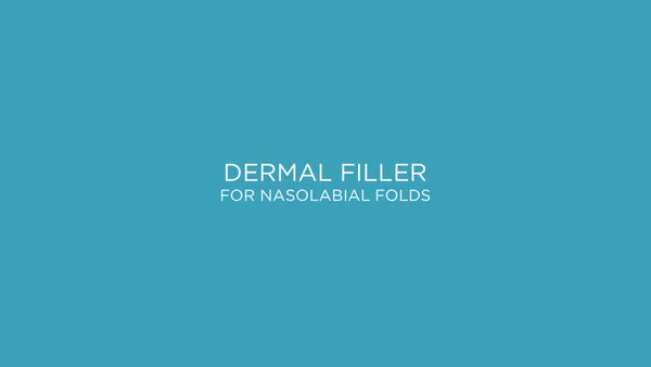 https://www.sanovadermatology.com/wp-content/uploads/video/Dermal-Fillers.jpg