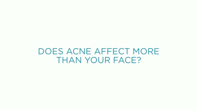 https://www.sanovadermatology.com/wp-content/uploads/video/acne.jpg